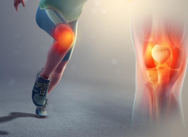 Runners-knee_SAG Runners-knee_SAG